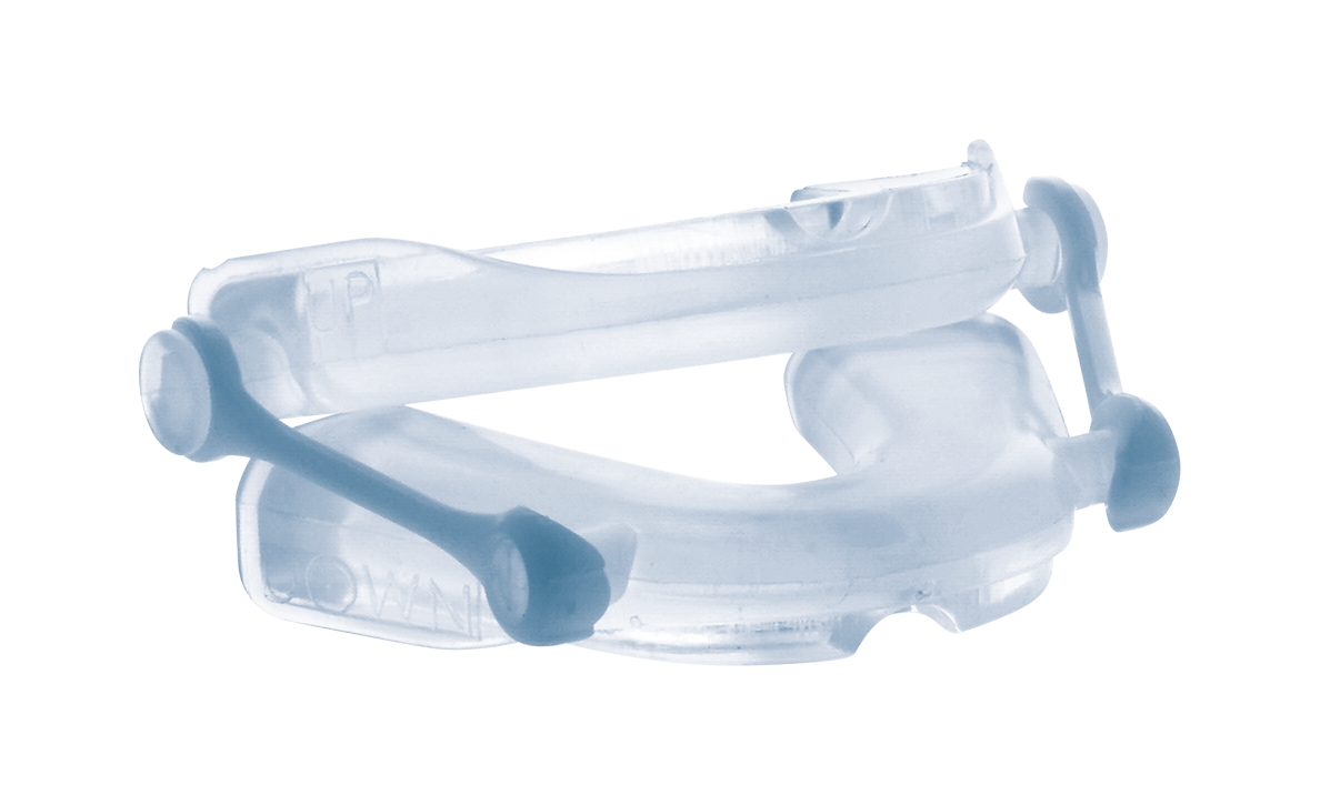 ONIRIS Mandibular Advancement Splint, an adjustable thermoplastic MAS for reducing snoring and OSA.