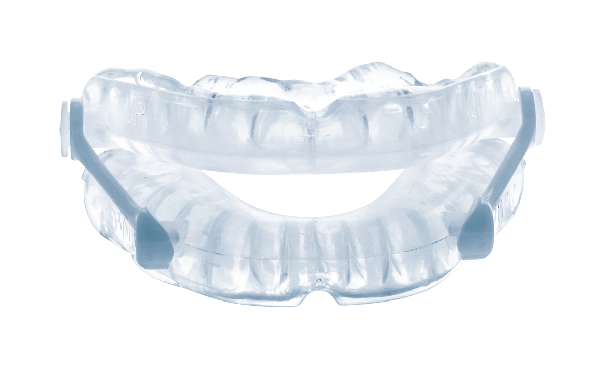 ONIRIS Mandibular Advancement Splint, an adjustable thermoplastic MAS for reducing snoring and OSA.