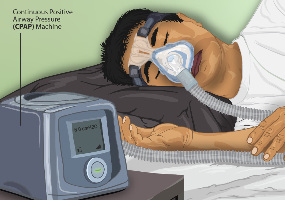 What Are CPAP Machines Used For?