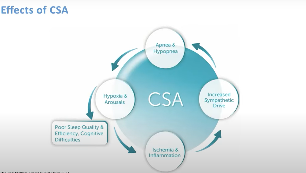 What Causes Central Sleep Apnea