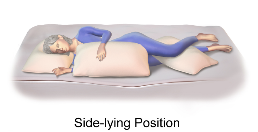 Sleep Position and Its Effect on Sleep Apnea