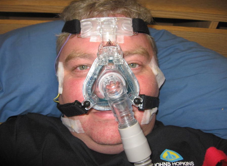How Many CPAP Machines Are Sold Each Year